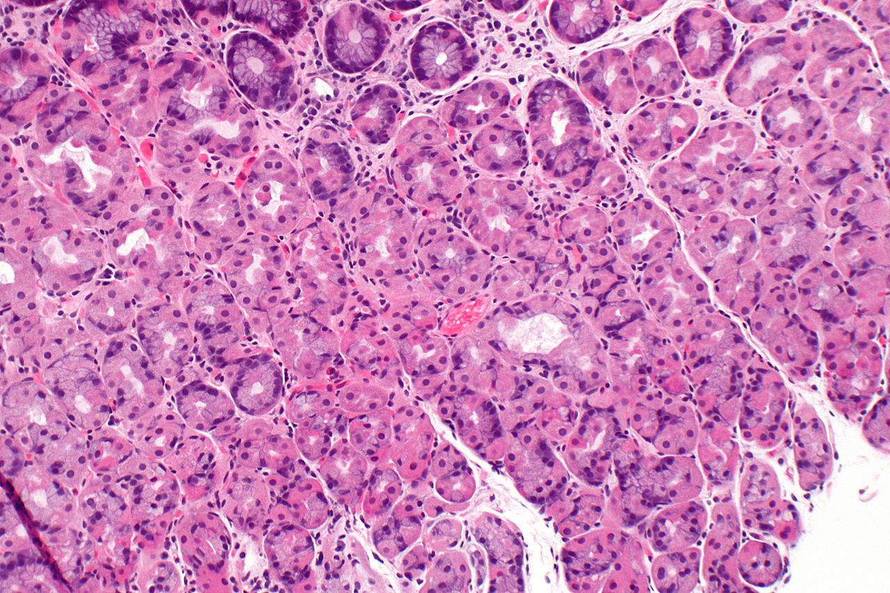 1280px-stomach_with_prominent_parietal_cells_-_intermed_mag